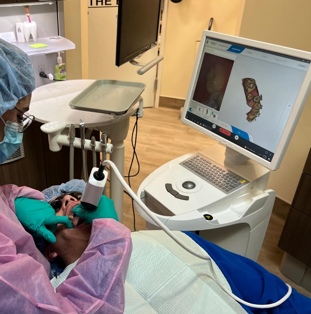 Intraoral scanner