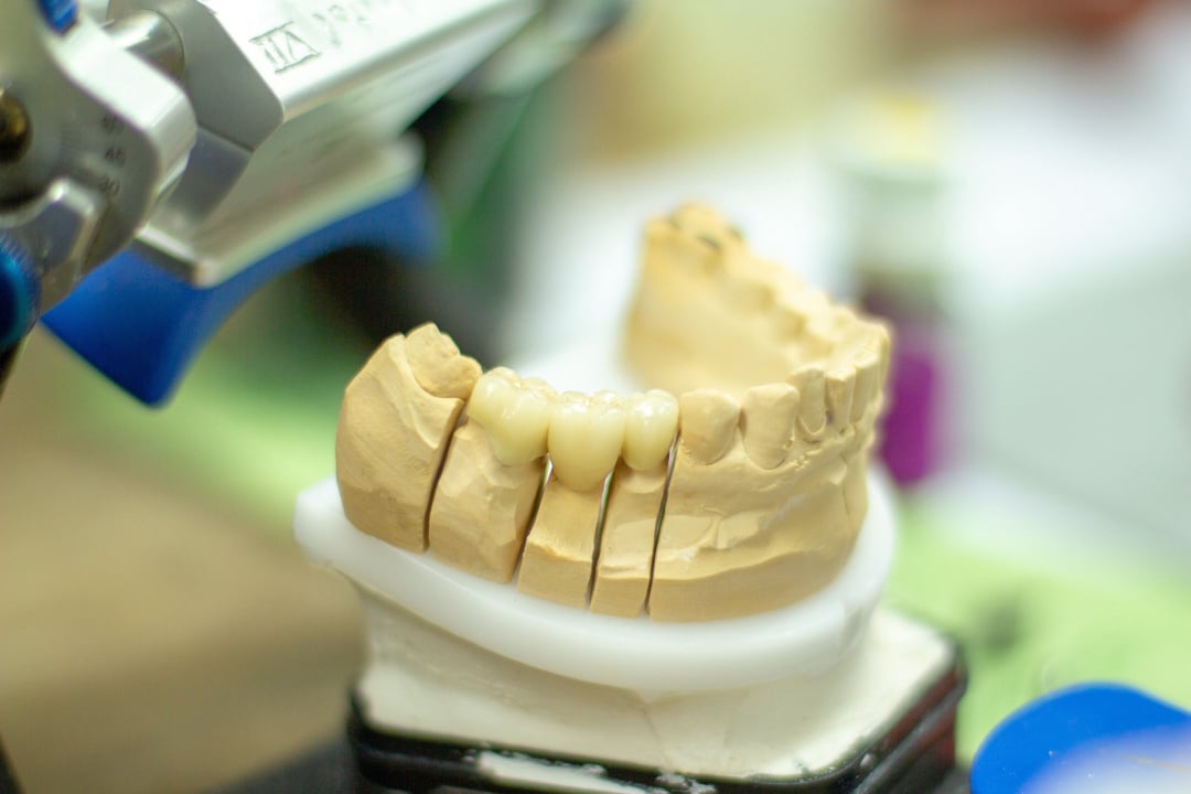 3d printers, mouth modeling