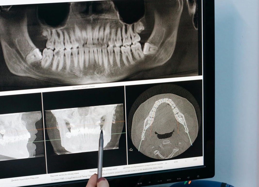 CBCT technology