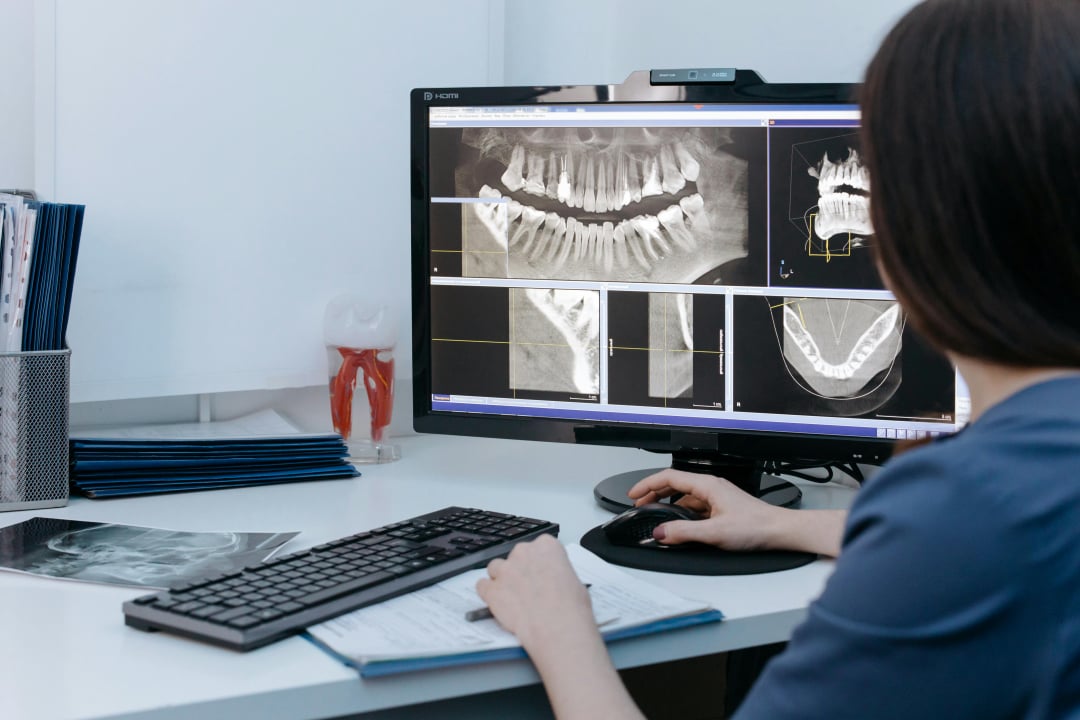 Digital xrays