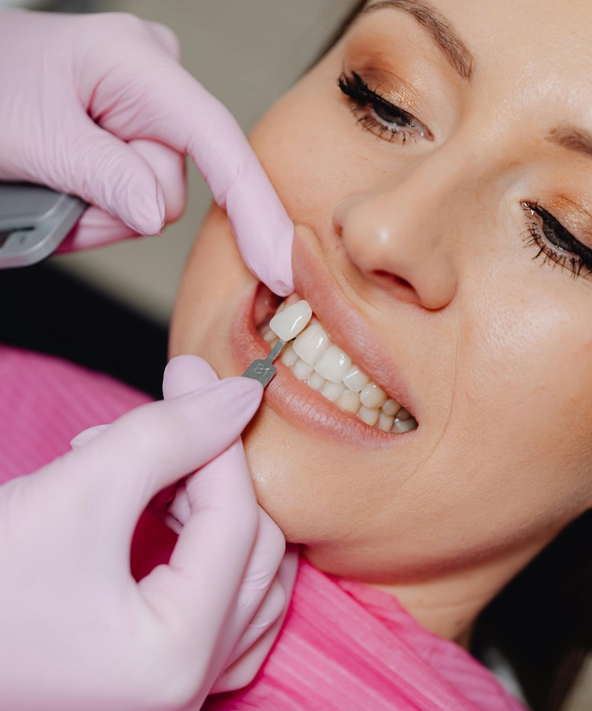A woman having dental veneers placed